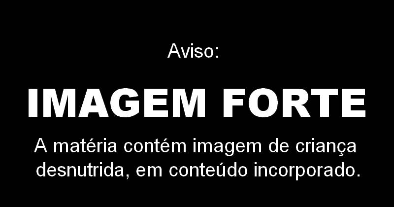 imagem forte - criança desnutrida