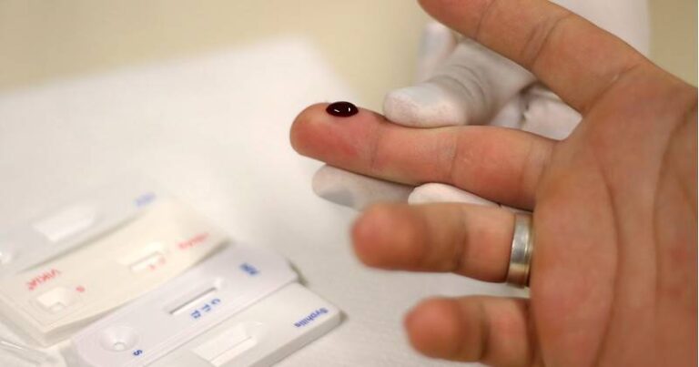 Teste HIV